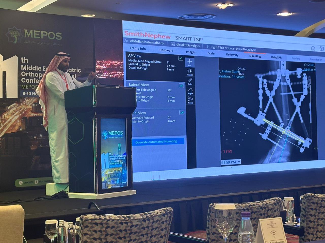 مشاركة د.طلال أبا الخيل  في ورشة عمل ومؤتمر جراحة عظام الأطفال في الشرق الاوسط MEPOS